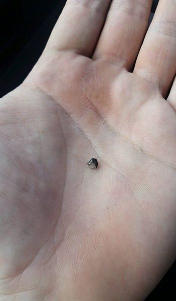 Moje plomba – to je bomba!